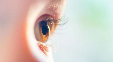 Retinoblastoma 